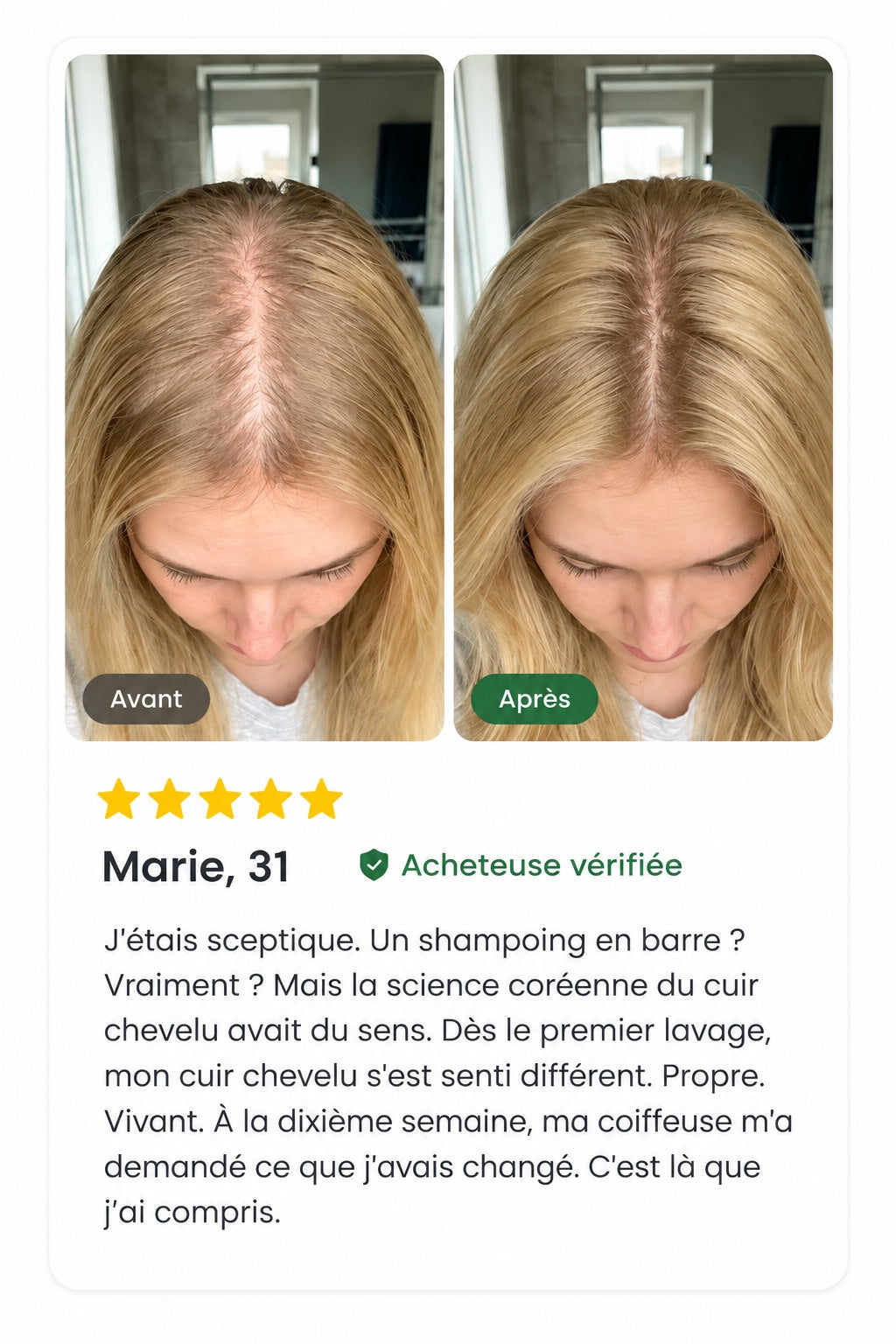 Avis vérifié — Marie, 31 ans, avant/après, 5 étoiles