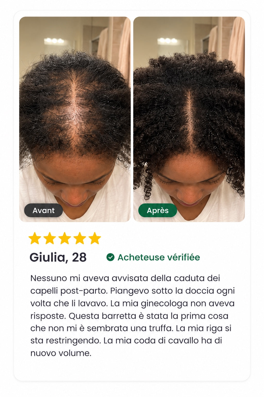Avis vérifié — Giulia, 28 ans, avant/après, 5 étoiles